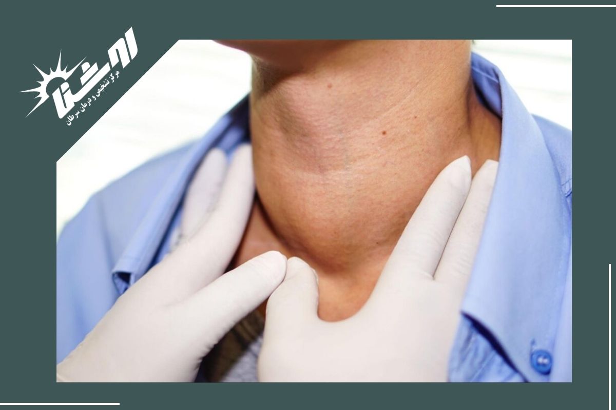 دلایل شایع توده های گردن دلایل شایع توده های گردن