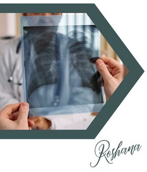 دلایل انجام بیوپسی ریه دلایل انجام بیوپسی ریه