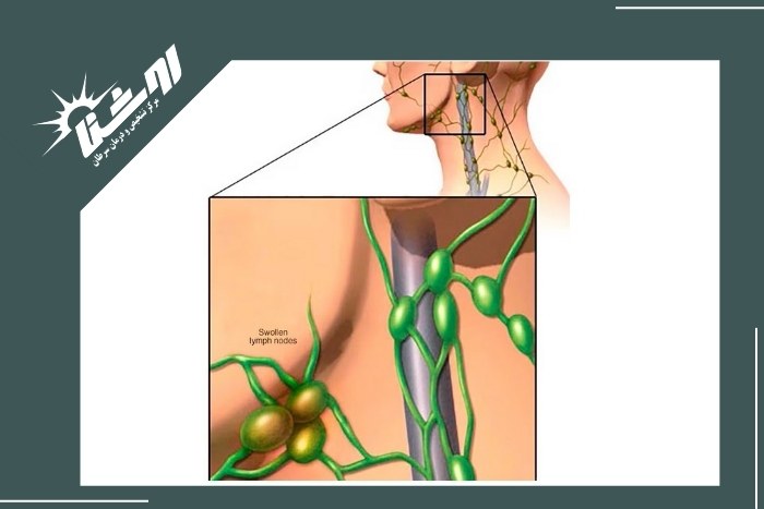 روش‌های تشخیص التهاب