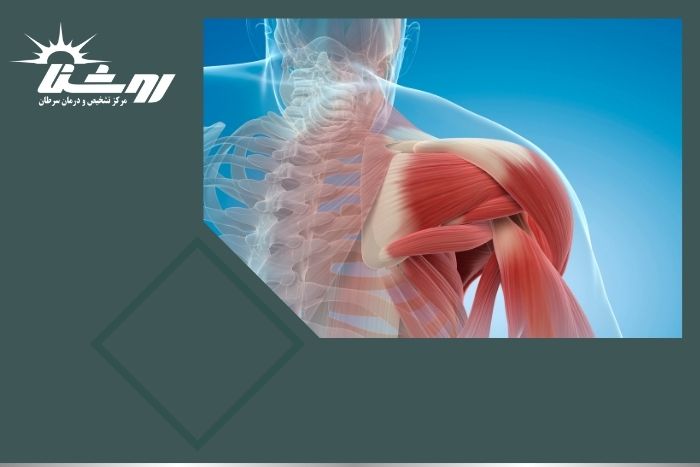 نمونه برداری عضله برای چیست و چه کاربردی دارد؟