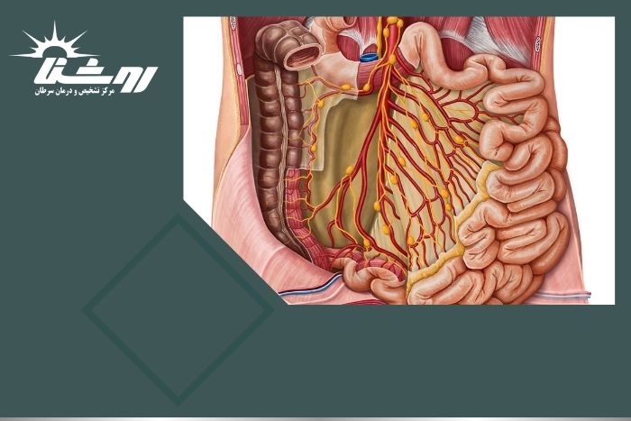 نمونه برداری از توده های داخل شکمی چگونه است؟