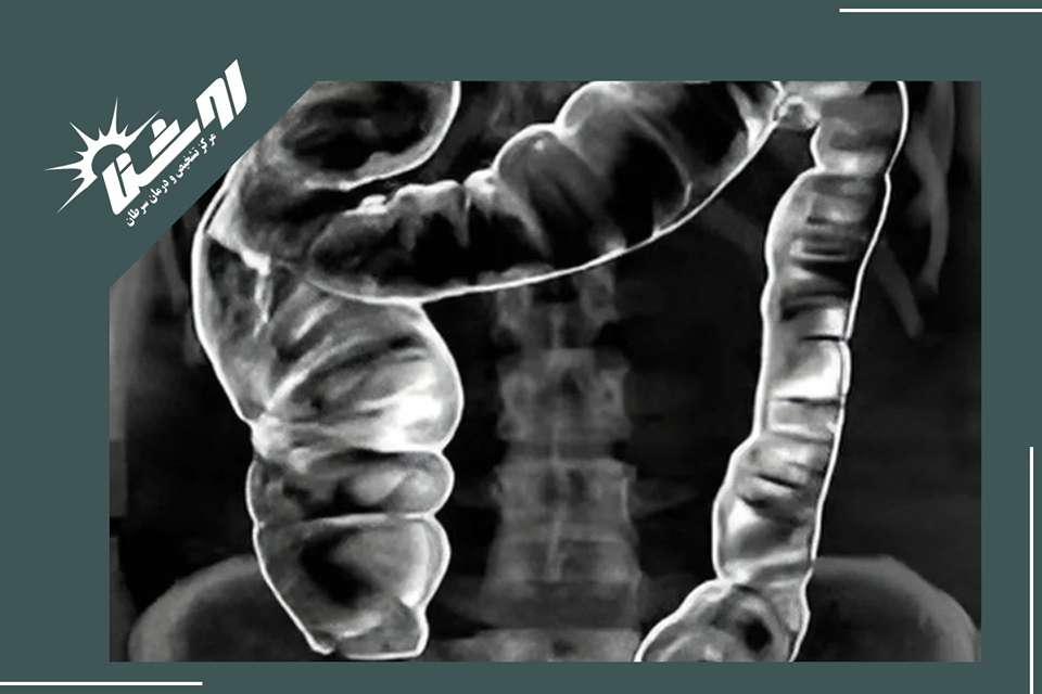 آمادگی‌های لازم قبل از گرافی باریوم