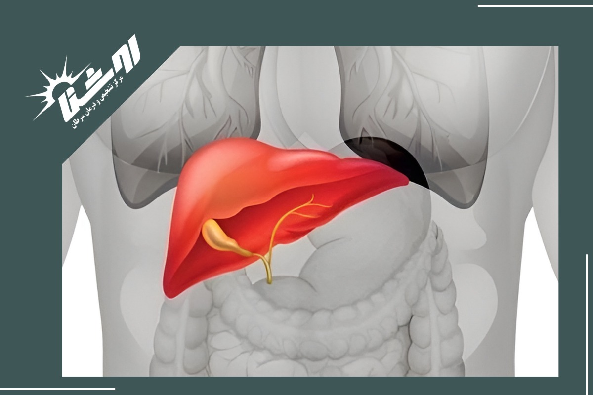 سونوگرافی شکم و لگن چیست؟ سونوگرافی شکم و لگن چیست؟