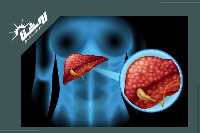 نکات مهم قبل از بیوپسی