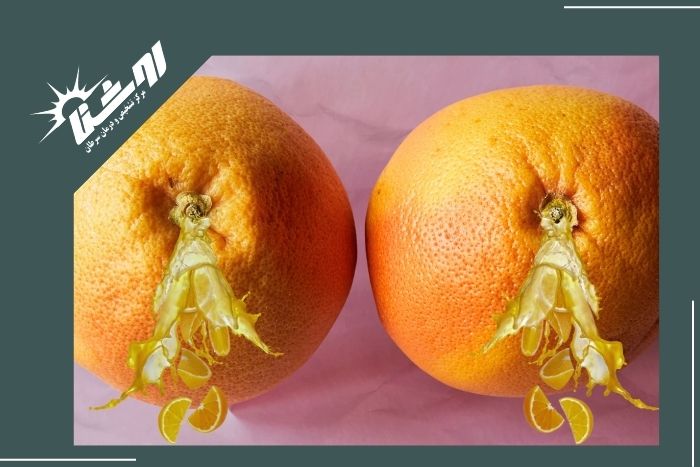 علل شایع ترشح از سینه علل شایع ترشح از سینه