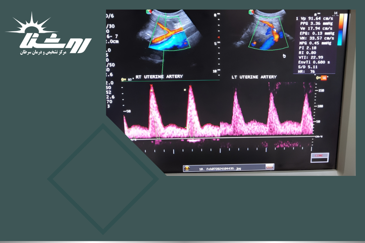 بهترین مرکز سونوگرافی داپلر در غرب تهران: مرکز روشنا