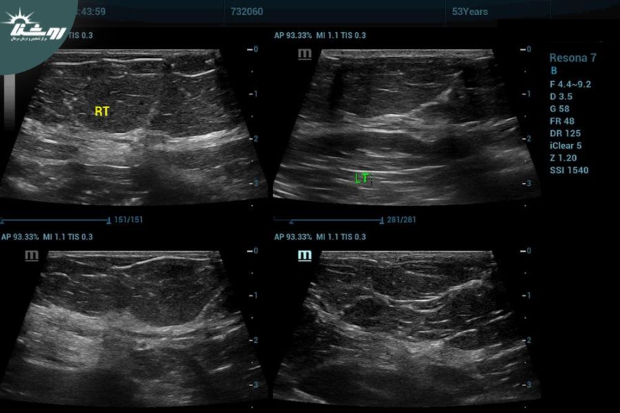 سونوگرافی 2