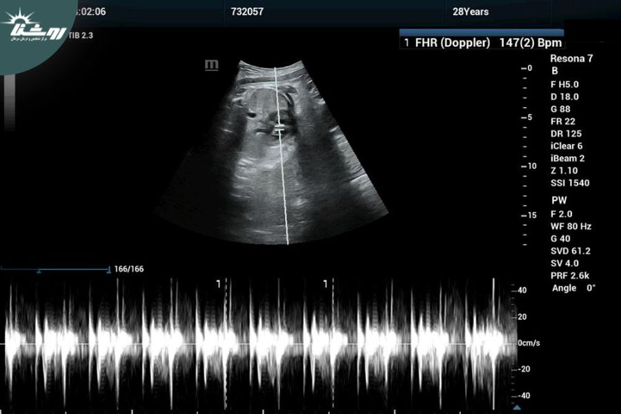 سونوگرافی 6