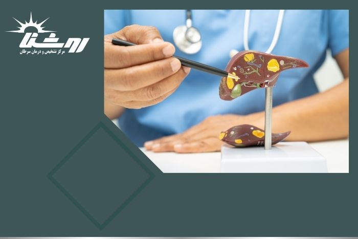 آیا سیروز کبدی همان سرطان است؟ بررسی علائم تا تشخیص