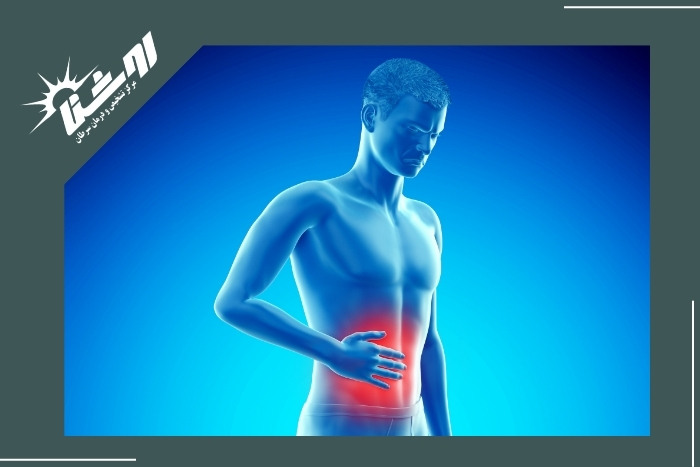 بیماری‌های مرتبط با درد مزمن شکم