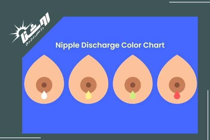 ترشحات خطرناک از پستان ترشحات خطرناک از پستان