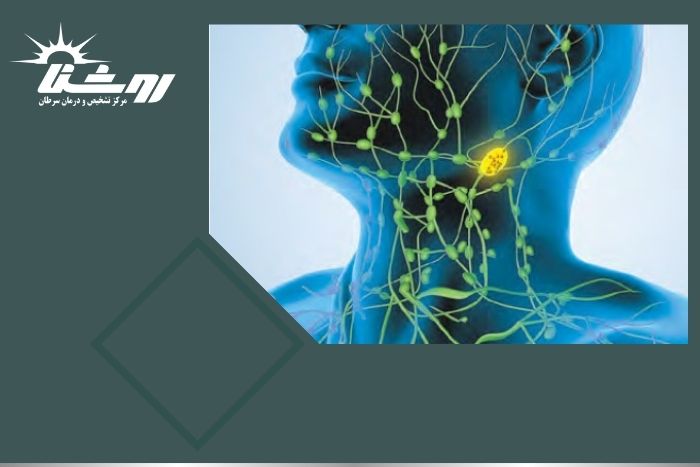 بهترین راه تشخیص سرطان غدد لنفاوی چیست؟ آنچه باید بدانید