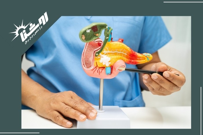 راهکارهای پیشگیری از سرطان لوزالمعده