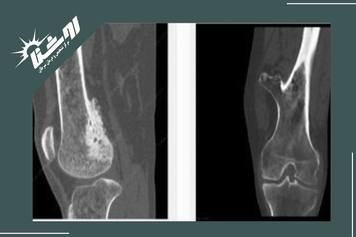 روش های تشخیص منشا درد