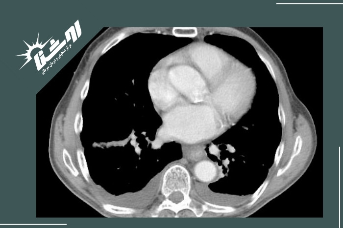 سایر روش‌های تشخیص