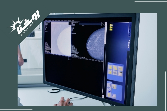 روش‌های تشخیص 