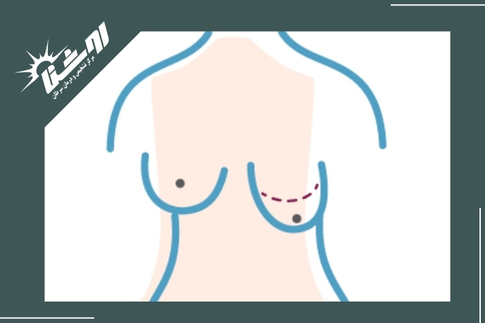 روش‌های تشخیصی