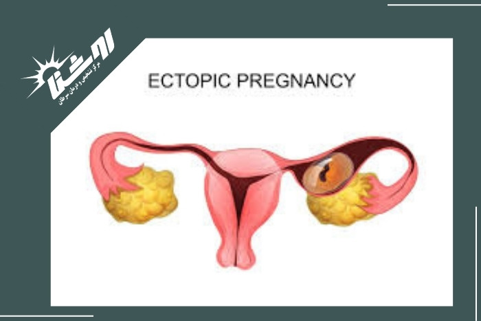 روش‌های درمان پس از تشخیص