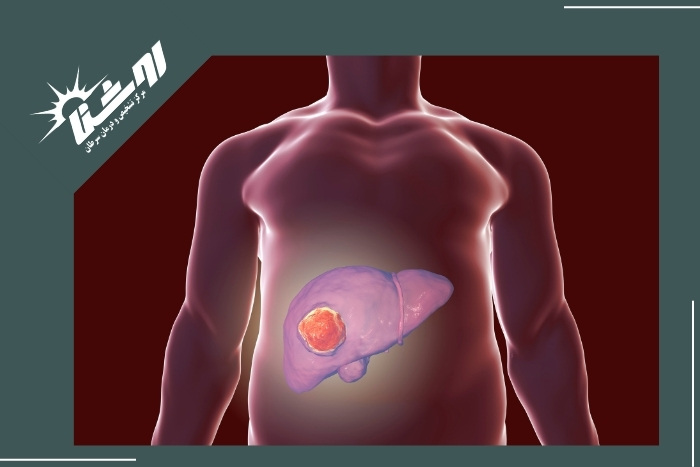 راه‌های پیشگیری