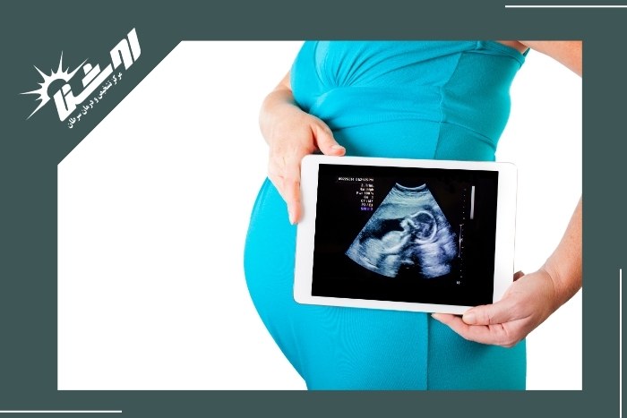 زمان انجام آخرین سونوگرافی بارداری