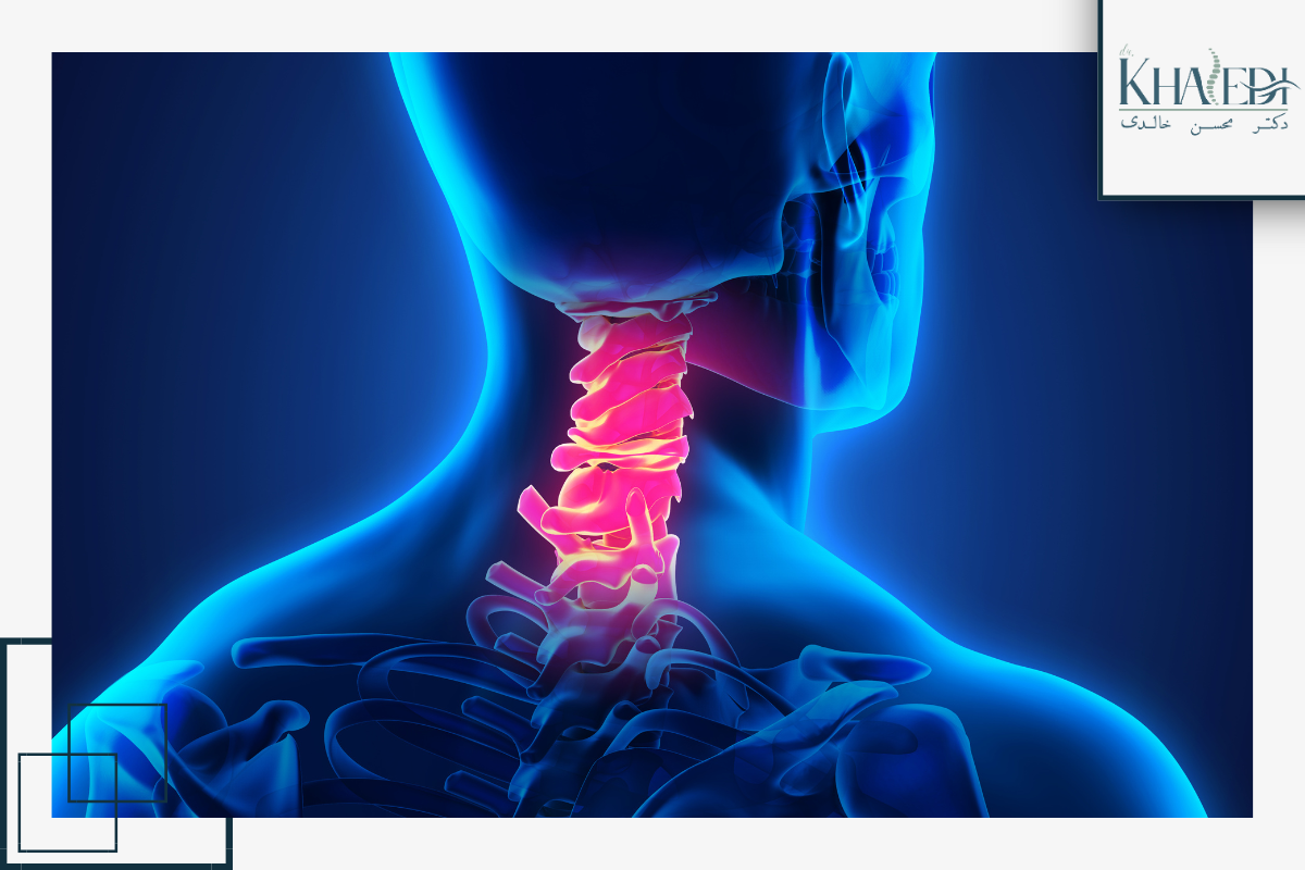 دلایل و عوامل مؤثر بر اسپوندیلوز گردنی دلایل و عوامل مؤثر بر اسپوندیلوز گردنی