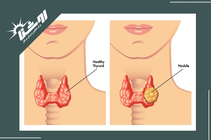 زمان‌هایی که می‌توان از بیوپسی صرف‌نظر کرد