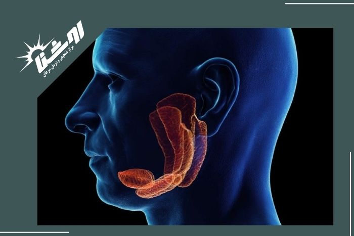 علائم التهاب غدد تولیدکننده بزاق