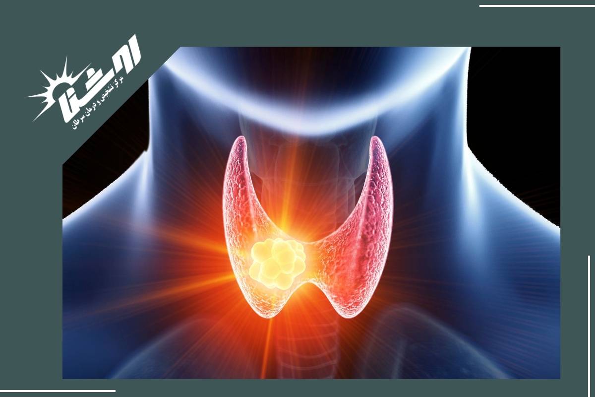 عوارض احتمالی نمونه‌برداری تیروئید