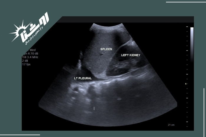 مزایای کلیدی اولتراسوند