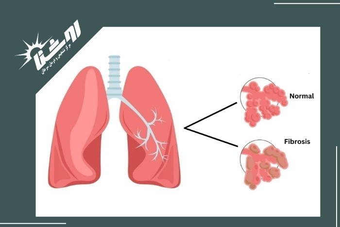 چگونه برای بیوپسی آماده شویم
