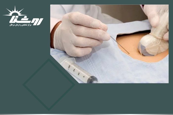 نمونه‌ برداری ریه برای چیست و چگونه است؟