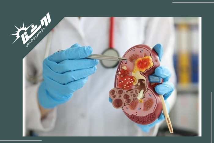 نکات مهم قبل از بیوپسی 