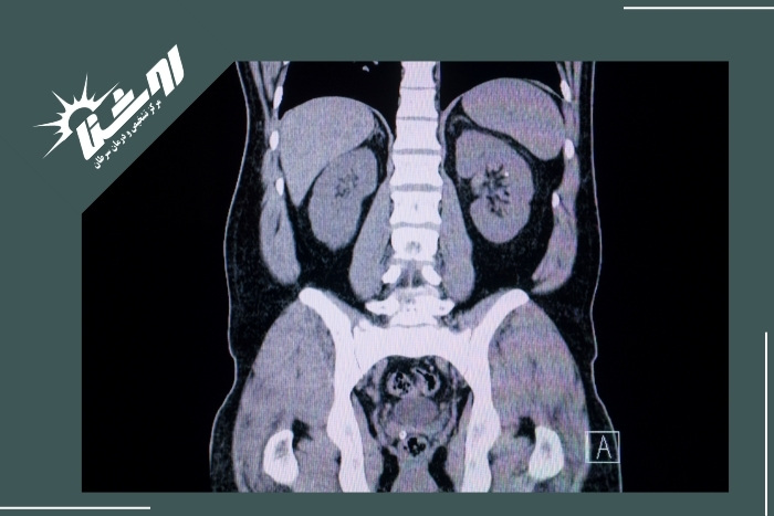 چرا آمادگی قبل از سی تی اسکن مهم است؟ چرا آمادگی قبل از سی تی اسکن مهم است؟