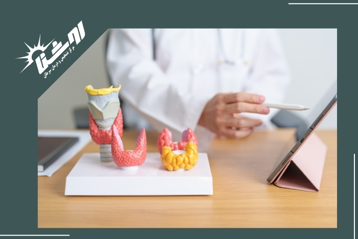چه کسانی به بیوپسی غده تیروئید نیاز دارند؟