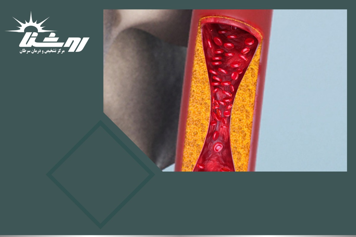 آیا درمان تیروئید با لیزر RF (امواج ماکروویو) موثر است؟