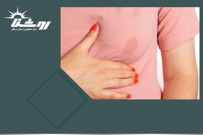 فیبروکیستیک شدن پستان چه تأثیری بر سلامت زنان دارد؟ فیبروکیستیک شدن پستان چه تأثیری بر سلامت زنان دارد؟