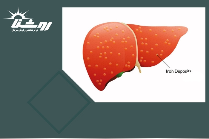 بهترین راه تشخیص سرطان پانکراس چیست؟