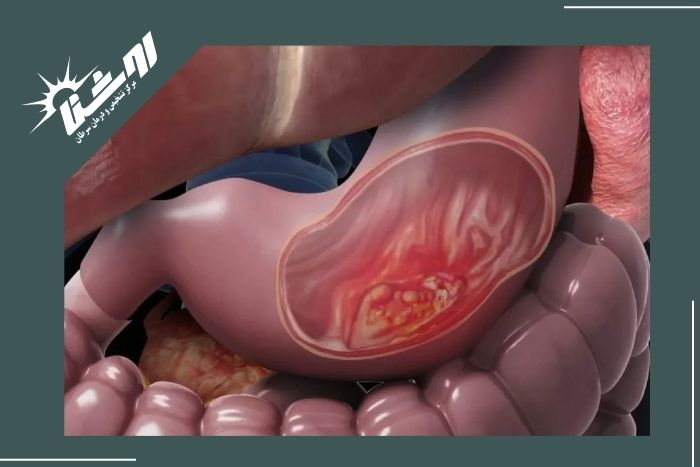چه علائمی نیاز به بررسی فوری و دقیق دارند؟ چه علائمی نیاز به بررسی فوری و دقیق دارند؟